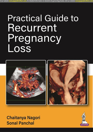 Practical Guide to Recurrent Pregnancy Loss