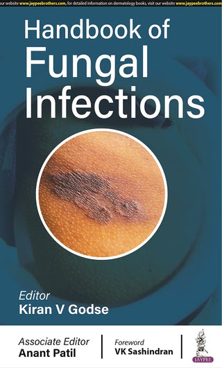 Handbook of Fungal Infections