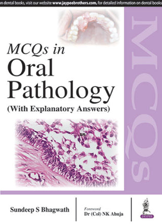 MCQs in Oral Pathology (With Explanatory Answers)