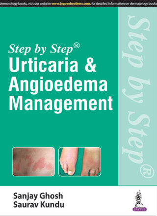 Step by Step Urticaria and Angioedema Management