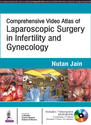 Comprehensive Video Atlas of Laparoscopic Surgery in Infertility and Gynecology (Includes Interactive DVD-ROMs)