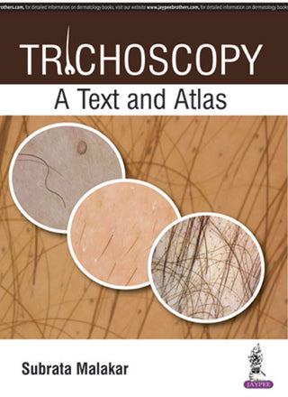 Trichoscopy: A Text and Atlas