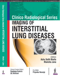 Clinico Radiological Series: Imaging of Interstitial Lung Diseases