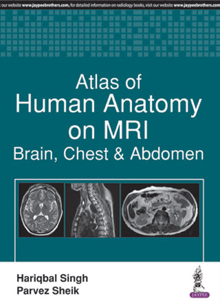 Atlas of Human Anatomy on MRI: Brain, Chest and Abdomen