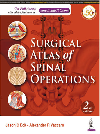Surgical Atlas of Spinal Operations
