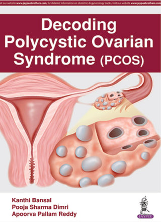 Decoding Polycystic Ovarian Syndrome (PCOS)
