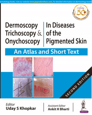 Dermoscopy, Trichoscopy & Onychoscopy in Diseases of the Pigmented Skin (An Atlas and Short Text)
