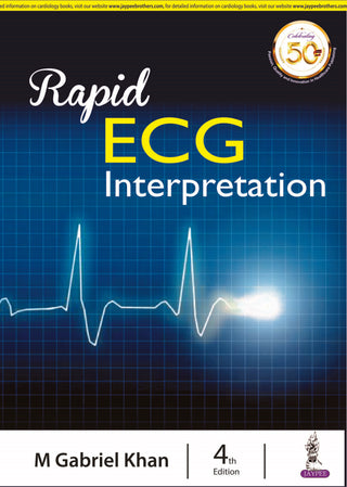 Rapid ECG Interpretation