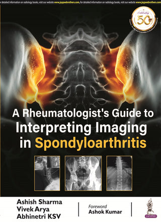 A Rheumatologist’s Guide to Interpreting Imaging in Spondyloarthritis
