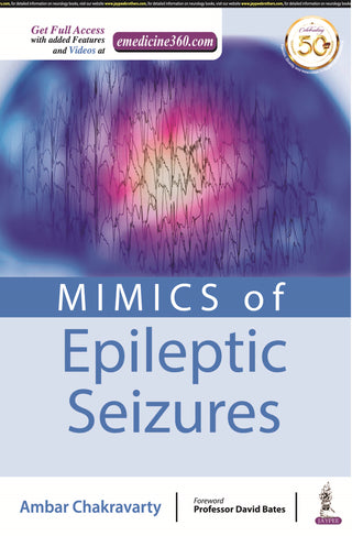 Mimics of Epileptic Seizures